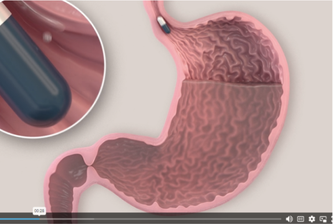 Market Development: Using 3D Video to Prepare the Market for a New Drug Delivery Platform